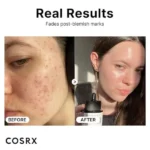 سرم نیاسینامید اسید کوزارکس