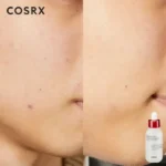 سرم ضد جوش و ضدلک کوزارکس ۴۰ میل