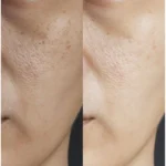 قیمت ژل شستشو ضدجوش و کنترل‌کننده چربی سراوی CeraVe