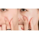 آمپول ضد چروک و حجم‌دهنده ۱۰۰ میل پپتید ۹ مدی پیل MediPeel