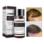 فروش روغن رشد و تقویت مو لانبنا LANBENA