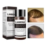 فروش روغن رشد و تقویت مو لانبنا LANBENA