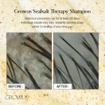فروش شامپو پاکسازی و کنترل چربی نمک دریا گروسGROWUS
