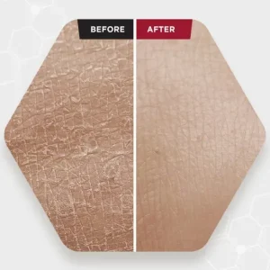 سرم پیلینگ و لایهبردار زامبی بلادی اسکین SKIN1004 1 قیمت سرم لایهبردار زامبی بلادی اسکین SKIN1004