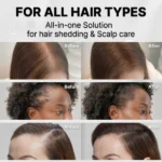 Buy Liliue Exosome Scalp Ampoule Model GROWTURN Exosome Spicule Ampoule 3000